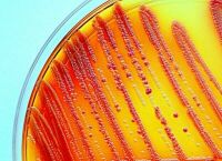 Imagem principal do artigo Monitoramento de Coliformes em Produtos Alimentícios: Assegurando Qualidade e Integridade Sanitária